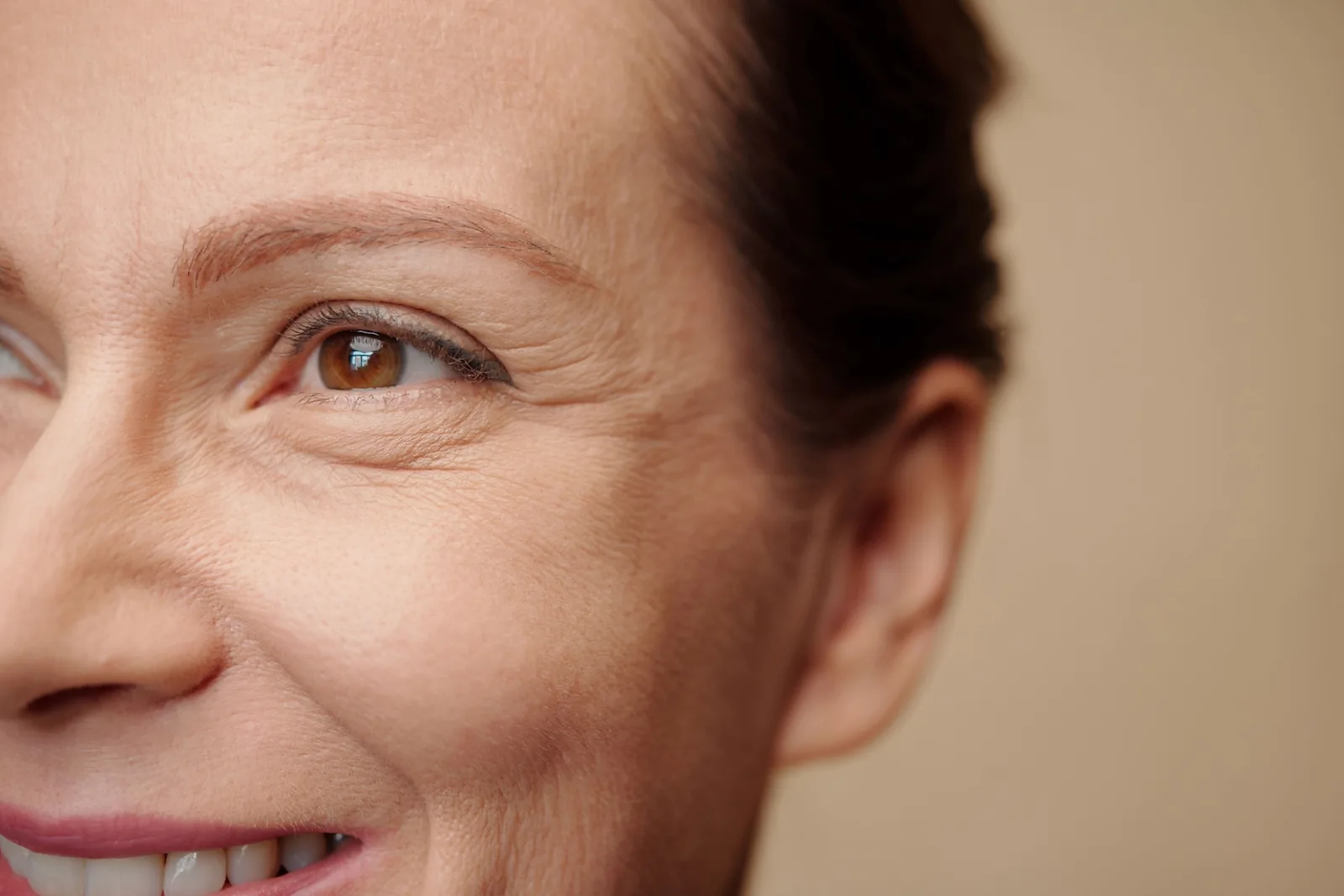 Close-up of a mature woman's eye area showing fine lines and early volume loss